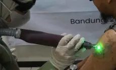FOTO: Program Hapus Tato Gratis