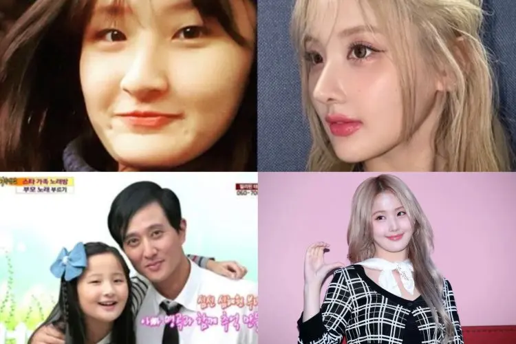 Foto Belle KISS OF LIFE Sebelum Debut Viral, Perubahan Besar Usai Operasi Plastik Terlihat