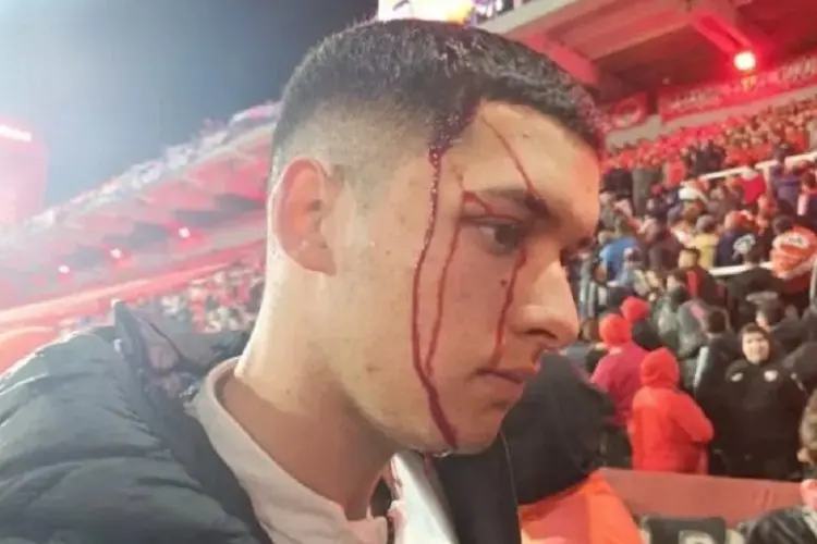 Begini Kronologis Kerusuhan Independiente vs Universidad de Chile, Penonton Ditelanjangi dan Dipukul