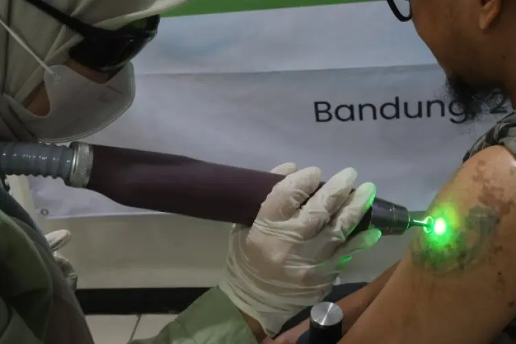 FOTO: Program Hapus Tato Gratis