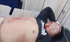Dua Remaja Bojonggede Jadi Salah Sasaran Tawuran