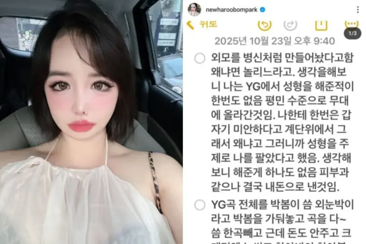 Usai Heboh dengan Gugatan, Park Bom Curhat Soal Operasi Plastik dan Ekploitasi yang Dilakukan YG