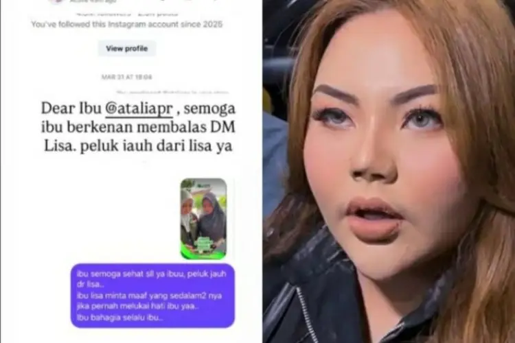 Minta Maaf ke Atalia Praratya Lewat DM, Lisa Mariana: Semoga Ibu Balas