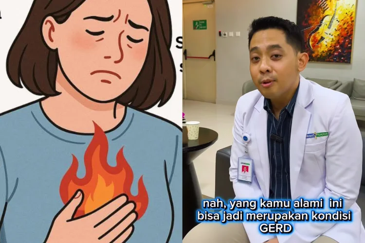 Apa Itu Gerd yang Viral di Medsos?? Begini Penjelasannya Menurut Dokter Rosandi