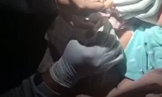 Jari Bayi Terlilit Rambut hingga Minta Bantuan Damkar di Bandung