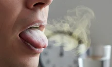 Jangan Lupa Gosok Gigi, Ini 4 Tips Supaya Tidak Bau Mulut saat Puasa Ramadan