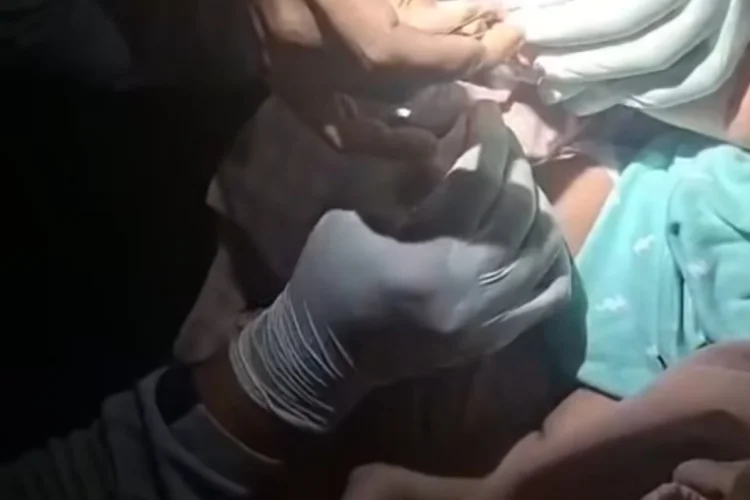 Jari Bayi Terlilit Rambut hingga Minta Bantuan Damkar di Bandung