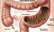 Begini Cara Cek Level Kotor Usus Selama Puasa Ramadan