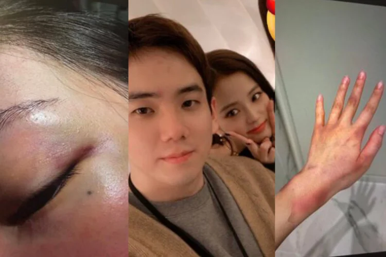 Tak hanya Pelecehan Seksual, Kakak Jisoo BLACKPINK juga KDRT pada Istrinya??