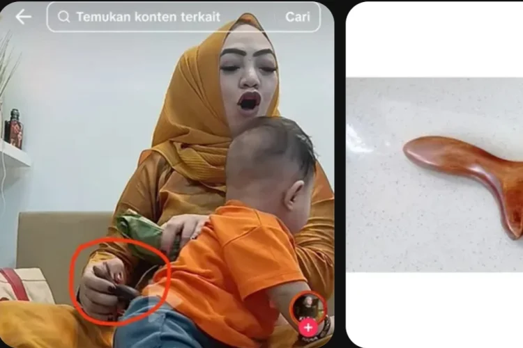 Terapi Bayi Viral Ternyata Gunakan Alat Kerokan Kayu, Warganet: Dewasa Saja Sakit!
