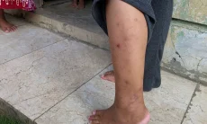 Eceng Gondok Tutupi Waduk Saguling, Warga Rancapanggung Diserbu Ribuan Nyamuk