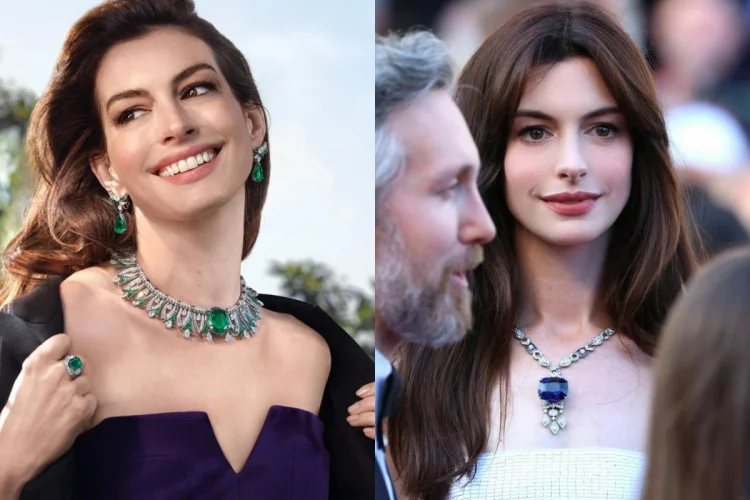 Baru Ungkap Sekarang, Ternyata Selama 10 Tahun Mata Anne Hathaway Buta Sebelah