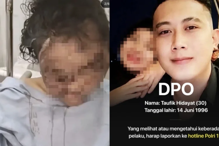 Ini Fakta-fakta Kasus Penganiayaan di Cileunyi: Taufik Hidayat Gunting Bibir Pacar