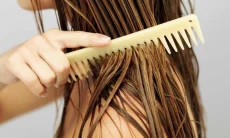 Transplantasi Rambut Kini Diminati Wanita, Pakar Ingatkan Risiko dan Biayanya