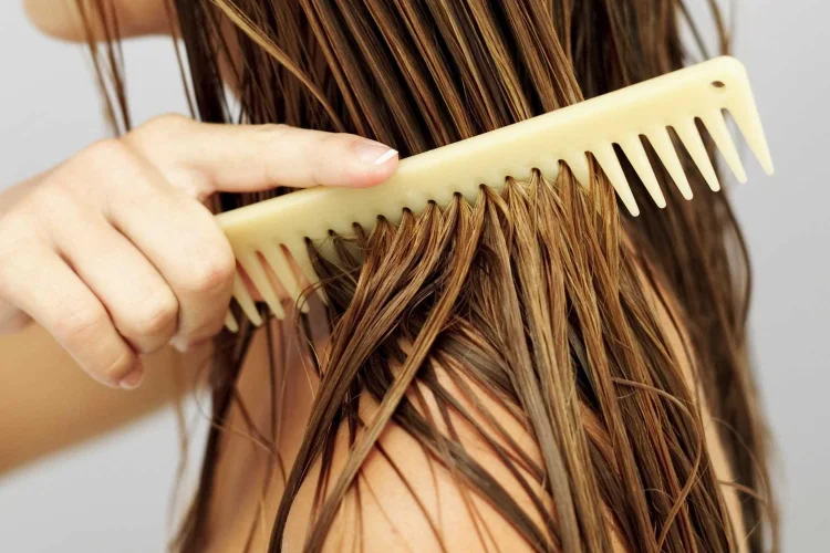 Transplantasi Rambut Kini Diminati Wanita, Pakar Ingatkan Risiko dan Biayanya