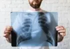 Penting! Ini Lima Cara Terhindar dari Tuberkolosis