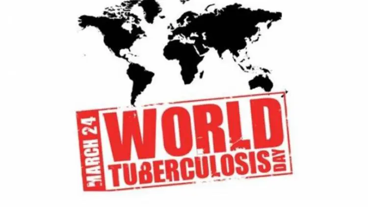 Jelang Hari Tuberkulosis Sedunia, Ini Cara Sembuhkan TBC