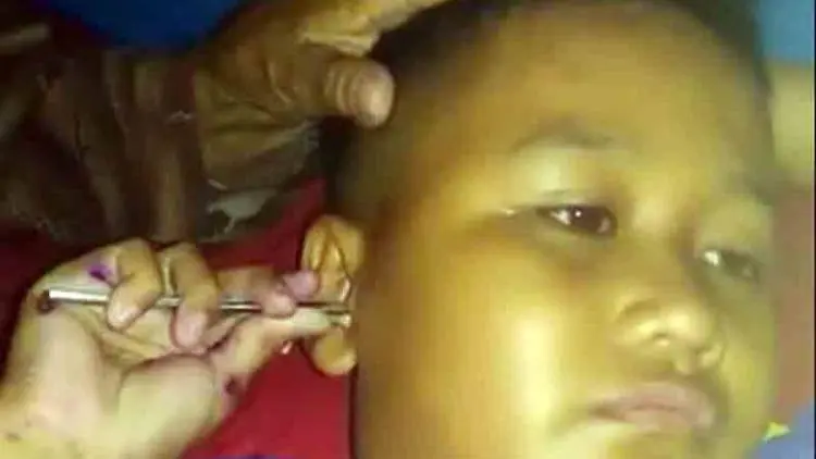 Subhanallah, Telinga Bocah di Majalengka Dipenuhi Semut dan Kertas
