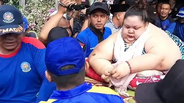 Perempuan di Karawang Berat 250 Kg Akibat Mi Instan