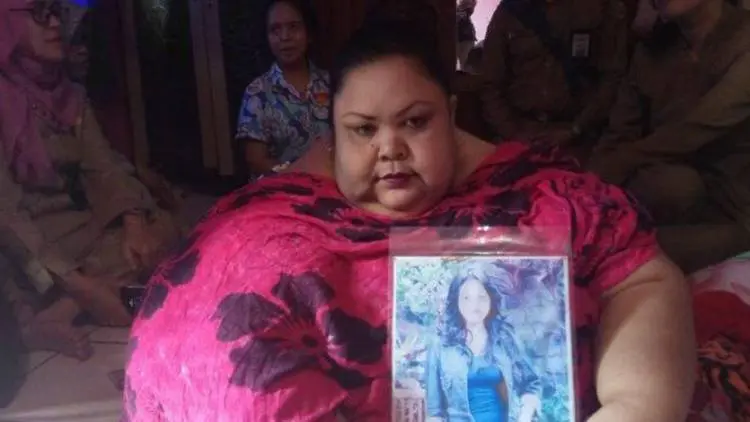 Ini Kata Pakar, Kronologi Obesitas Titi Wati