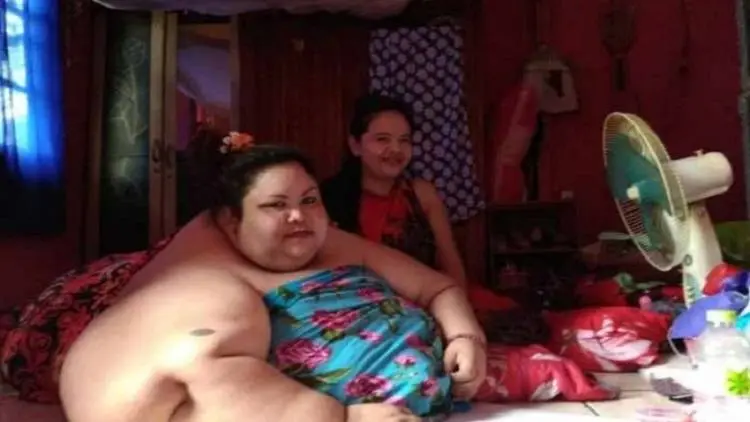 Alhamdulillah, Wanita Berbobot 300 Kg Segera Naik Meja Operasi