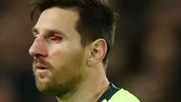 Meski 'Ditabrak Truk', Messi Tetap Fit Lawan Manchester United