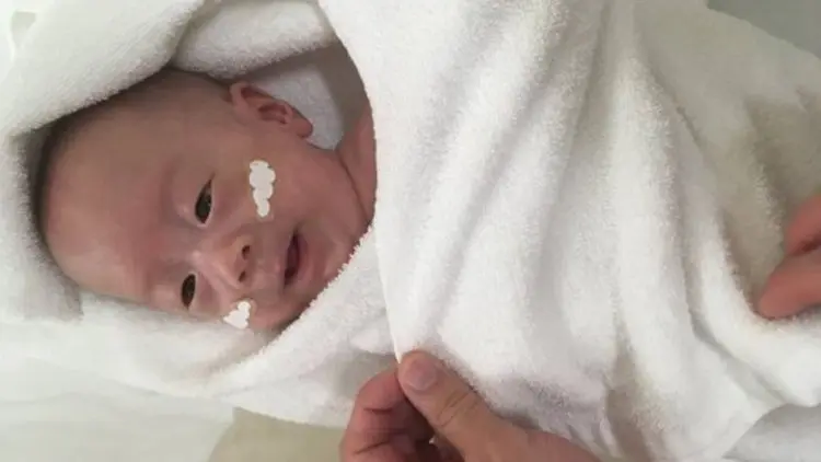 Bayi Terkecil Dunia Akhirnya Pulang ke Rumah