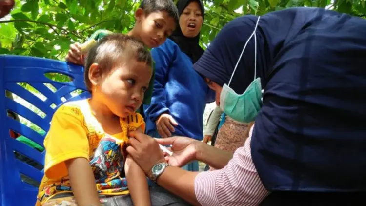 UNICEF: Jutaan Anak Tak Divaksin Campak, Ciptakan Wabah