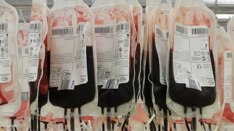 Ada Darah Terinfeksi HIV, Begini Antisipasi PMI Purwakarta