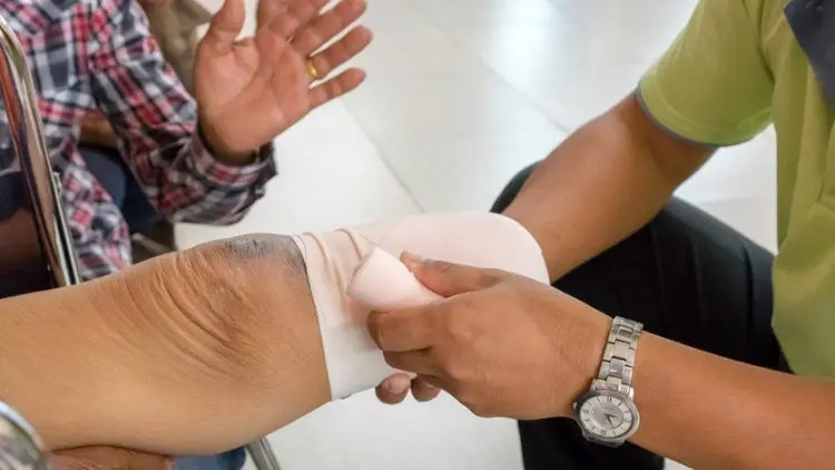 Tidak Semua Kanker Tulang Harus Diamputasi