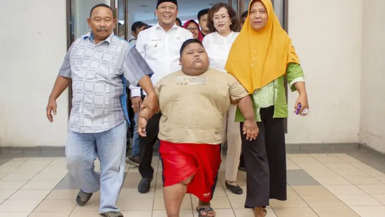 Usia 7 Tahun, Berat 101 Kg, 'Bocah Raksasa' Ini Dirujuk ke RSHS