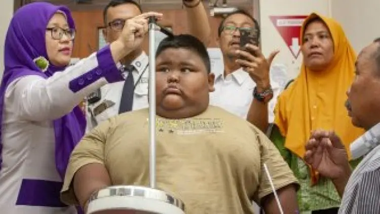 Dinas Kesehatan Karawang Baru Mendeteksi 4 Kasus Obesitas