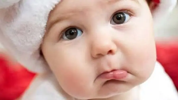 Kenali Kelaian Bibir pada Anak Sejak Dini