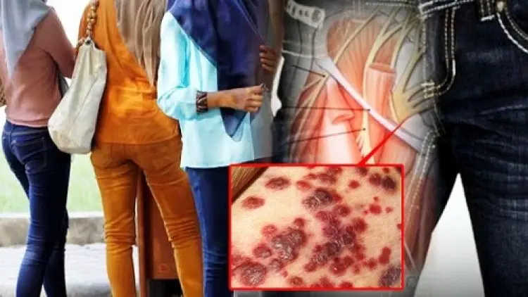 11 Bahaya Berpakaian Terlalu Ketat