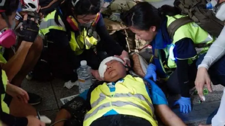Kondisi Jurnalis WNI Tertembak Peluru Karet di Hong Kong Stabil