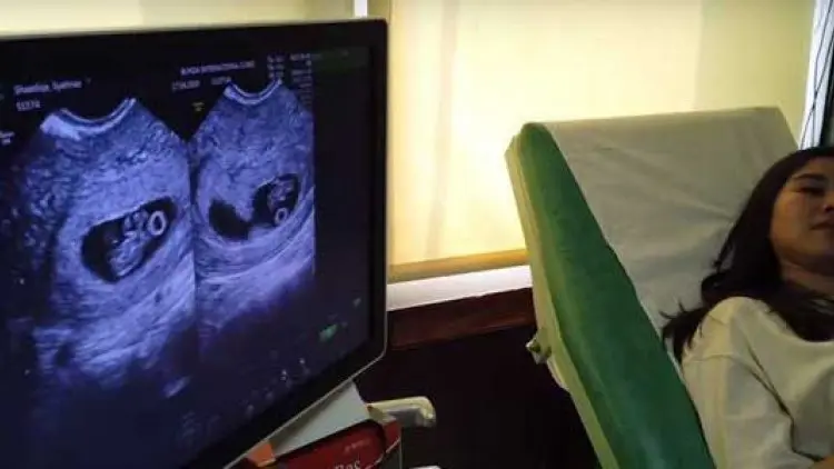 Hamil Bayi Kembar, Shahnaz Sadiqah Merawat Diri