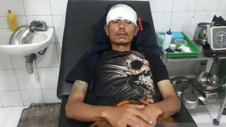Nahas, Tukang Ojek Pangkalan di Cianjur Jadi Korban Begal