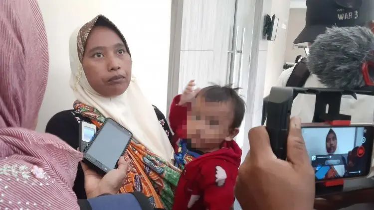 Jabar Jadi Kantong Terbesar Penderita Bibir Sumbing
