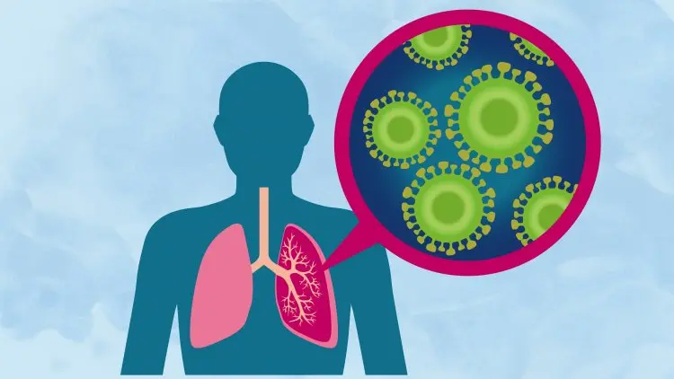 Ngeri, Pneumonia Bunuh Satu Anak per 39 Detik
