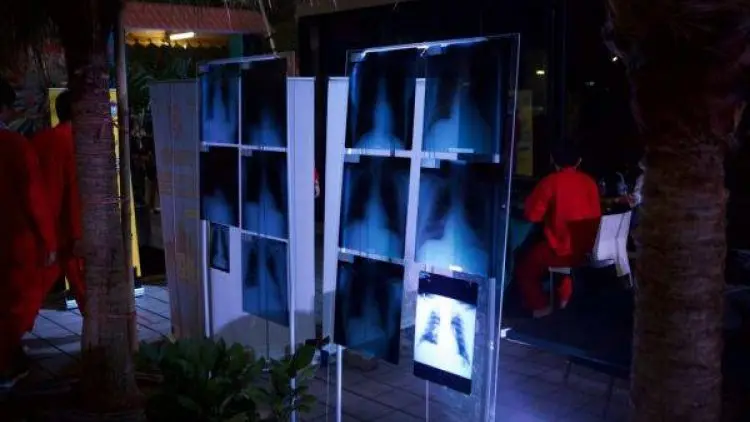 Vape Sehat, Komunitas Pengguna Pamer Hasil Rontgen