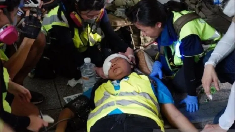 Mata Tertembak Aparat, Veby Mega Indah Tuntut Hong Kong Tanggung Jawab