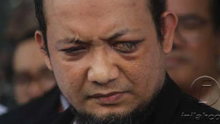 Novel Bakal Penuhi Panggilan Penyidik