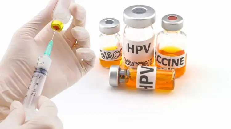 Keterlambatan Vaksinasi HPV