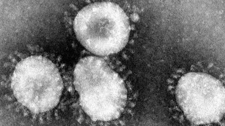 Apple Turun Tangan Bantu Korban Virus Corona