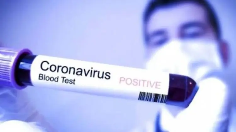 132 Tewas karena Virus Corona, Jepang Evakuasi 206 Warga dari Wuhan