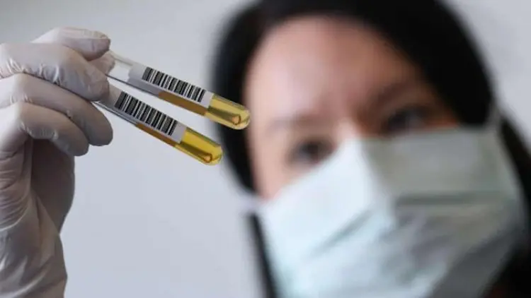 Uji Coba Plasma Darah di AS Dihentikan