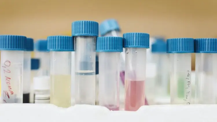 Tes RT Lamp Saliva Dikembangkan Jadi Alternatif Selain PCR dan Antigen