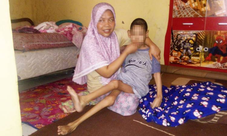  Ilham Dwiguna Warga Soreang 18 Tahun Menderita Gizi Buruk
