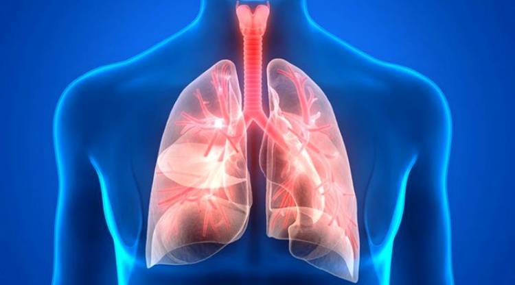 Perhatikan Perbedaan Pneumonia dan TBC 
